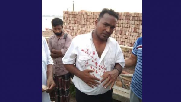 জমি নিয়ে বিরোধ : ফতুল্লার বক্তাবলীতে ভাগিনাকে হত্যার চেষ্টা