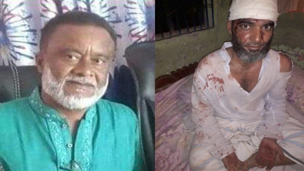 ফতুল্লায় পিতা-পুত্রের উপর সন্ত্রাসী সেন্টু বাহিনীর হামলা