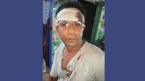 ফতুল্লায় তুচ্ছ ঘটনায় প্রতিবেশীর মারধরের শিকার প্রবাসী
